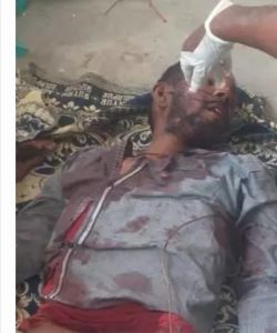 Read more about the article आज पुन्हा हायवे ने घेतला एक बळी. सरकारी दवाखाना चौक येथे घडला अपघात जागीच इसम ठार.