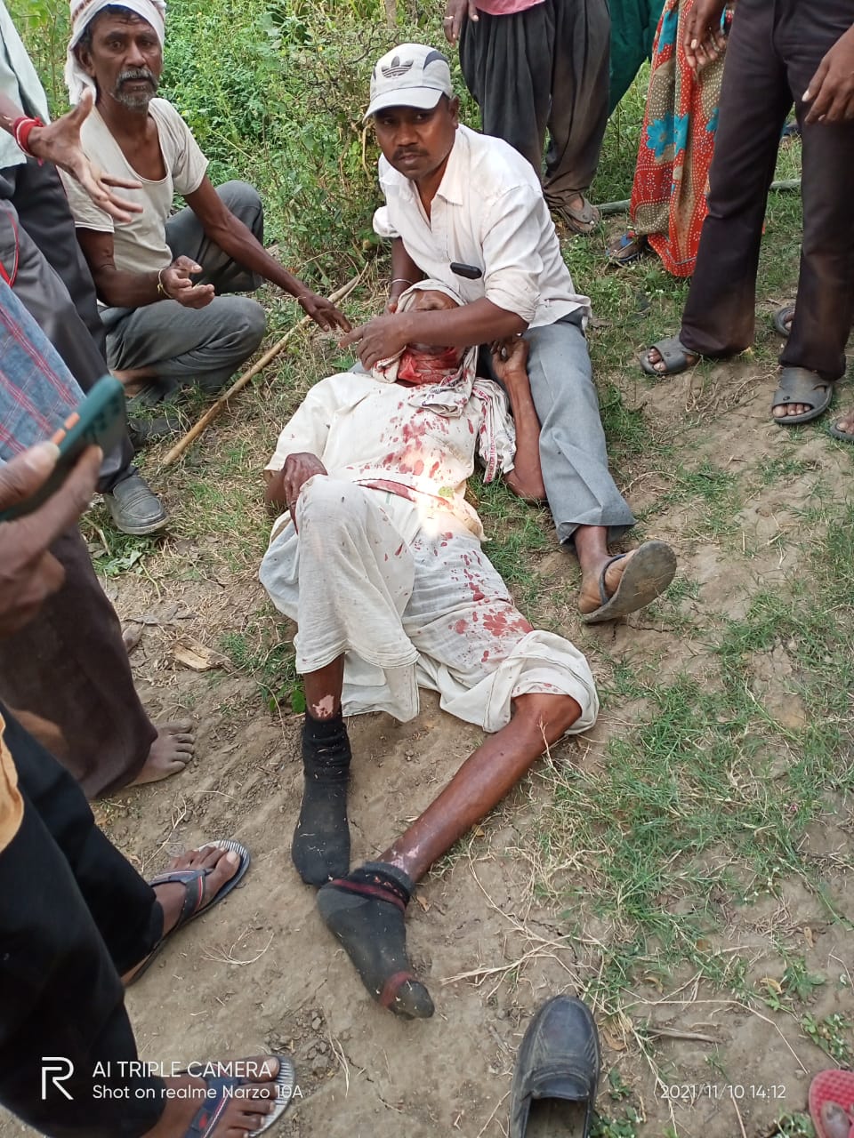 Read more about the article भटाळा या शिवारात वाघाचा  हल्ला ,रुग्णालयात दाखल