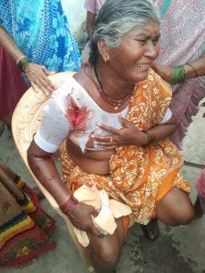 Read more about the article वाघाच्या हल्यात महिला गंभीर जखमी,पोंभूर्णा कोठारी वनपरीक्षेत्रातील घटना