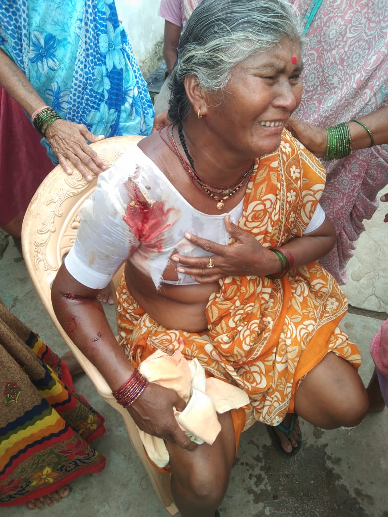 Read more about the article वाघाच्या हल्यात महिला गंभीर जखमी,पोंभूर्णा कोठारी वनपरीक्षेत्रातील घटना