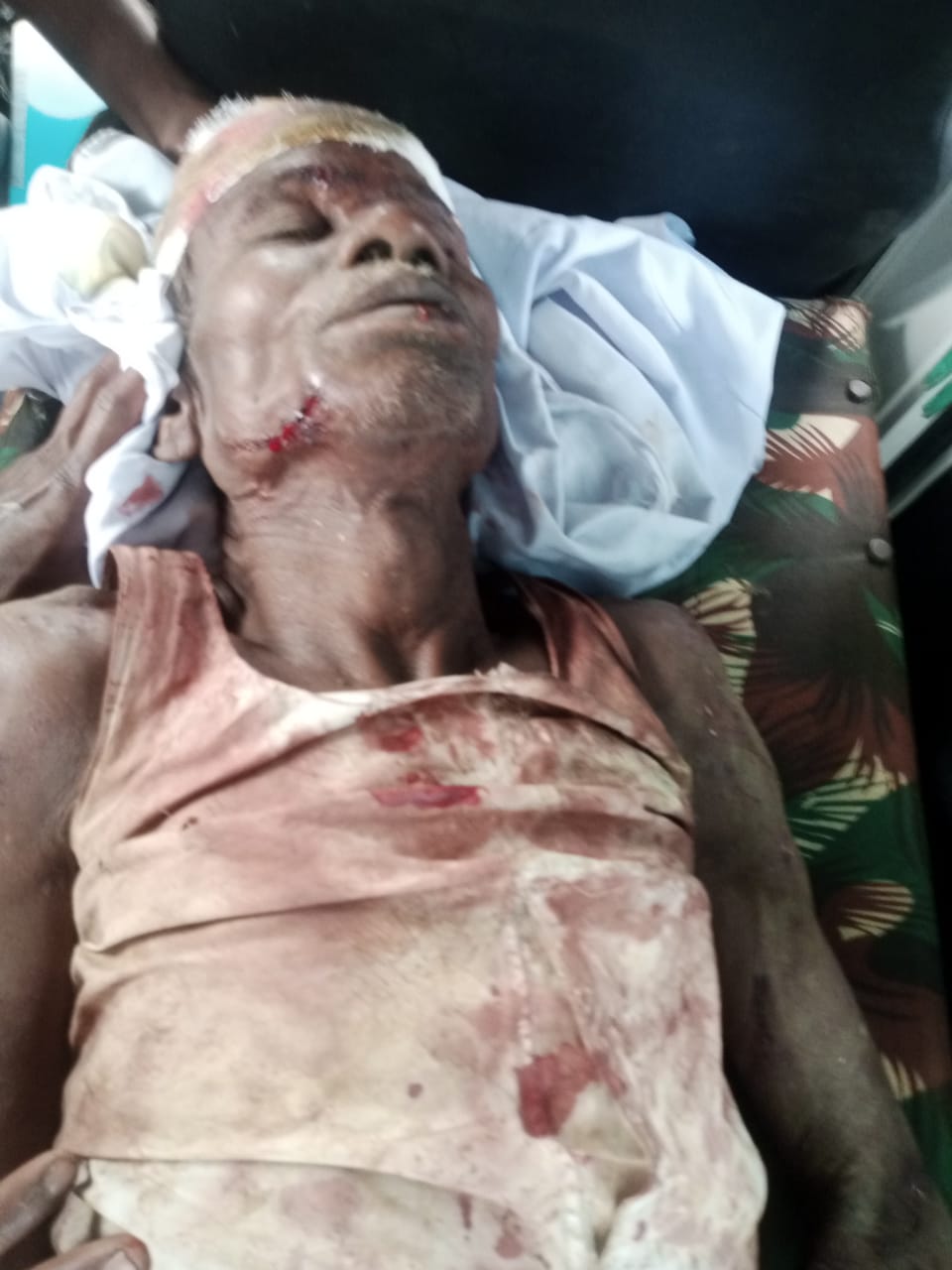 Read more about the article रानडुकराचा शेतकऱ्यांवर हल्ला,दोघे जखमी : वन्यप्राण्यांचा बंदोबस्त करण्याची मागणी