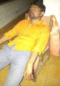 Read more about the article रेल्वे गेटमॅनला युवकाकडून जबर मारहाण