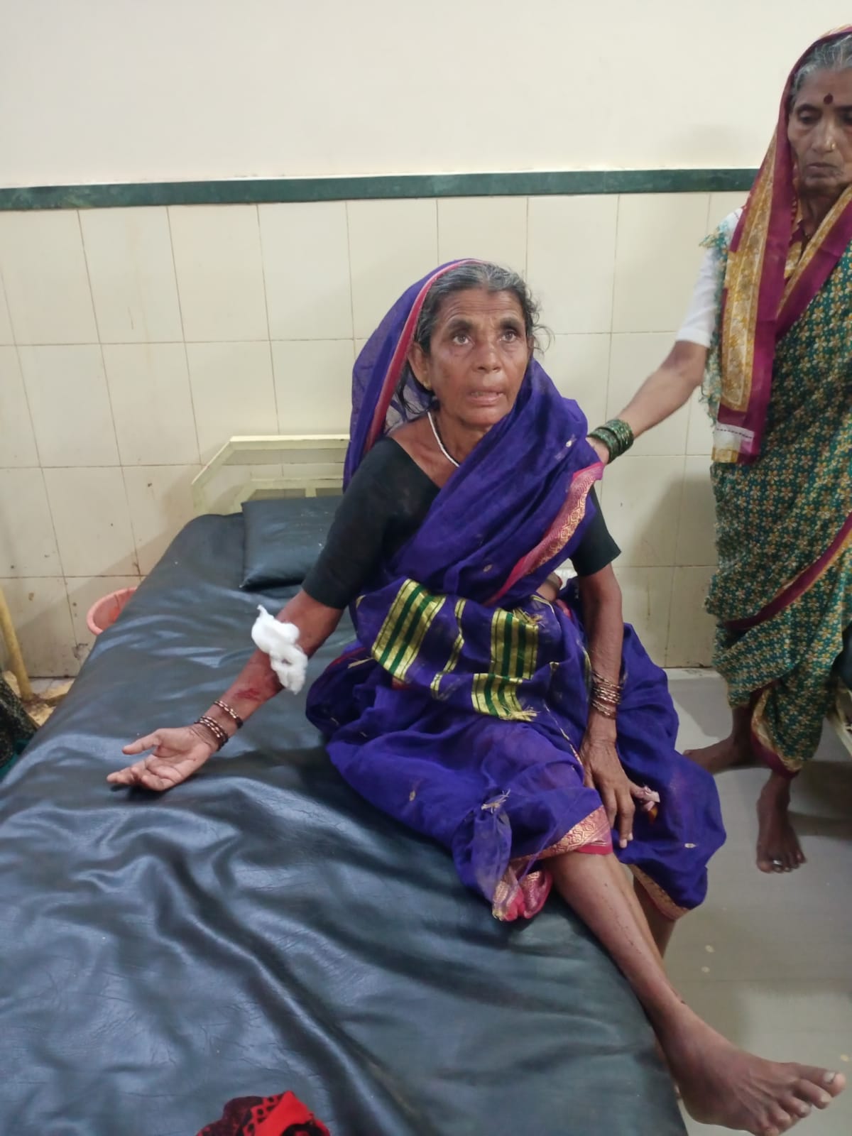 Read more about the article सावळेश्वर येथील वृद्ध महिलेला रानडुकरांनी धडक देऊन चावा घेतल्याची घटना