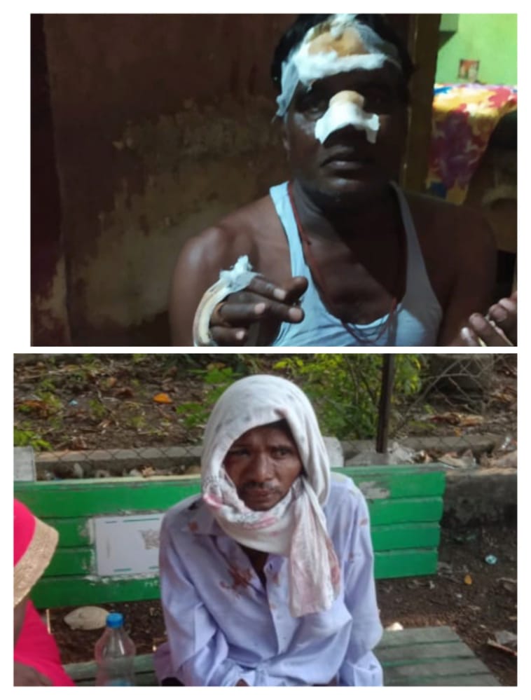 Read more about the article डुक्कराची दुचाकीस्वारास धडक दोघेजण गंभीर जखमी