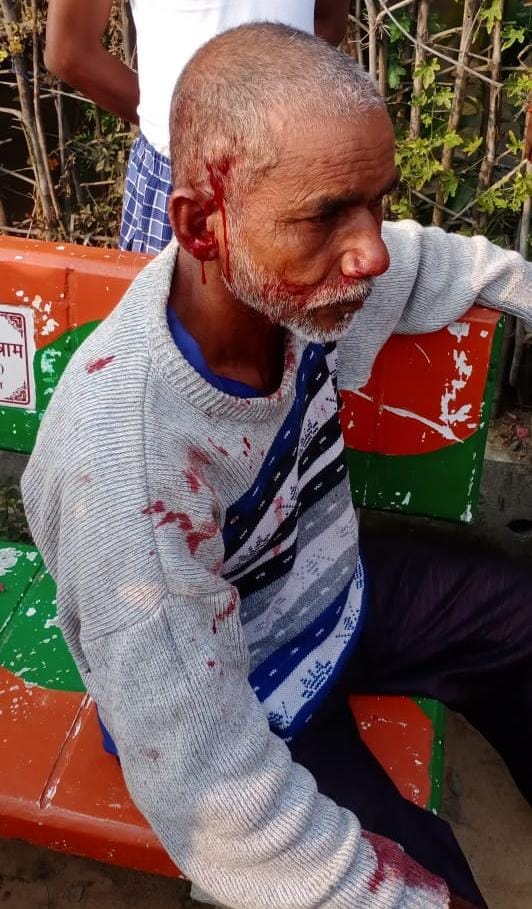 Read more about the article बिबट्याच्या हल्यात शेतकरी गंभीर जखमी,गावकऱ्यांमध्ये भीतीचे वातावरण