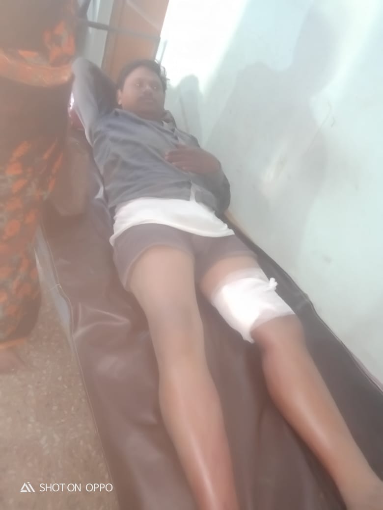 Read more about the article शेतकऱ्यावर रानडुकराचा हल्ला