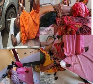 Read more about the article चवताळलेल्या रानडुकराच्या हल्ल्यात एका महिलेचा मृत्यू तर पुरुष गंभीर  पार्डी शेत शिवारातील दुर्दैवी घटना