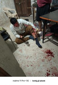 Read more about the article <em>रेती तस्करांचा तलाठ्यावर जीवघेणी हल्ला</em><br><em>वाळू वाहतूक सुरु ठेवण्यावरून तलाठी कार्यालयामध्ये तिघांनी केला हल्ला</em>