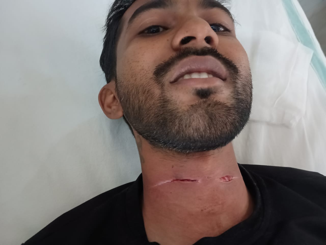 Read more about the article <em>नायलॉन मांज्याने चिरला युवकाचा गळा</em><br><em>सुदैवाने वाचले 28 वर्षे युवकाचे प्राण</em><br><em>पवनार येथील पवनार वरूड रोडवरील घटना</em>